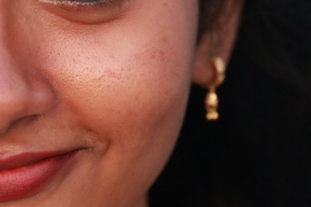 Natural facial expression and visible skin texture in a South Asian woman; an illustrative photograph, not a Botox result. Photo by Aradra P on Pexels.